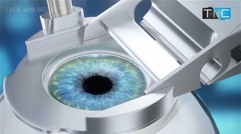 Best Ophthalmology Hospitals in the World